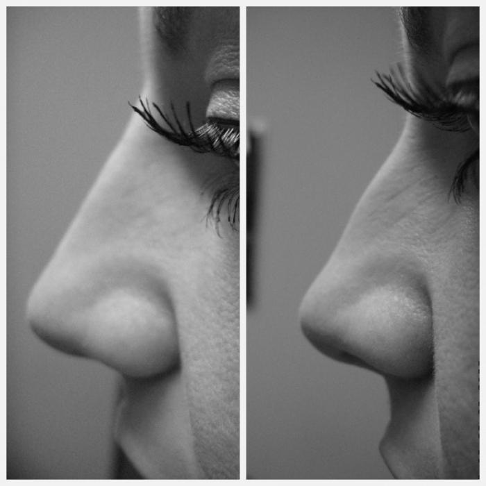 Typy nosních tvarů 