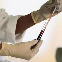 Obecný krevní test v normě pro děti